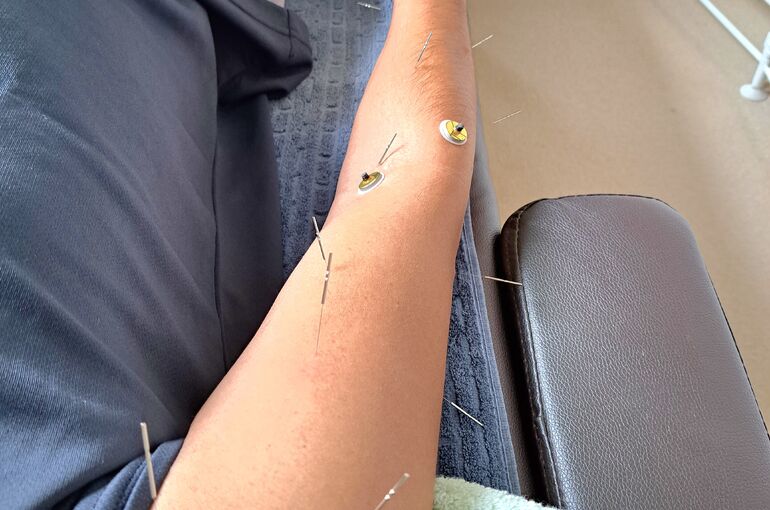 傷を癒し・治す東洋医学、橈骨神経麻痺・下垂手の回復